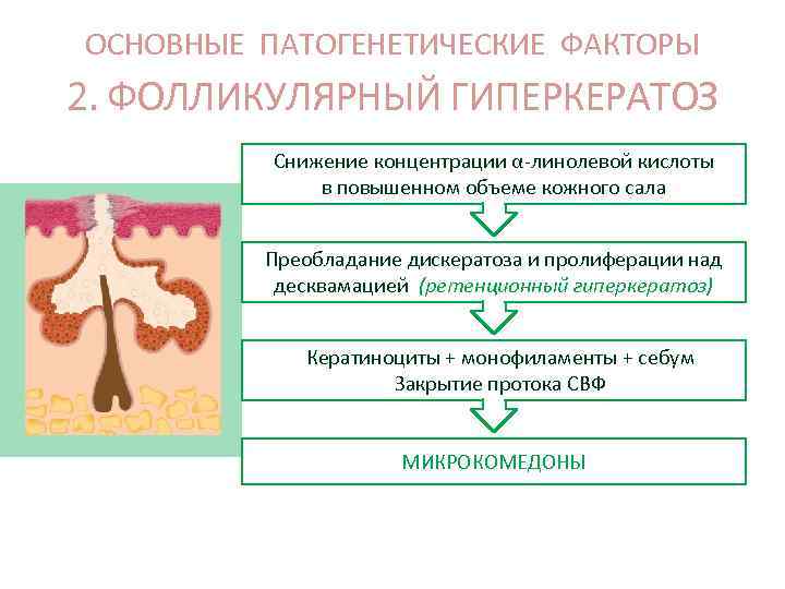 ОСНОВНЫЕ ПАТОГЕНЕТИЧЕСКИЕ ФАКТОРЫ 2. ФОЛЛИКУЛЯРНЫЙ ГИПЕРКЕРАТОЗ Снижение концентрации α-линолевой кислоты в повышенном объеме кожного
