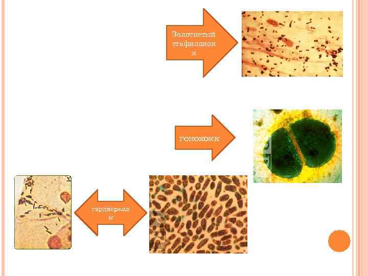 Золотистый стафилокок к гонококк гарднерелл ы 