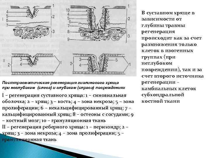 Посттравматическая регенерация гиалинового хряща при неглубоком (слева) и глубоком (справа) повреждениях I – регенерация