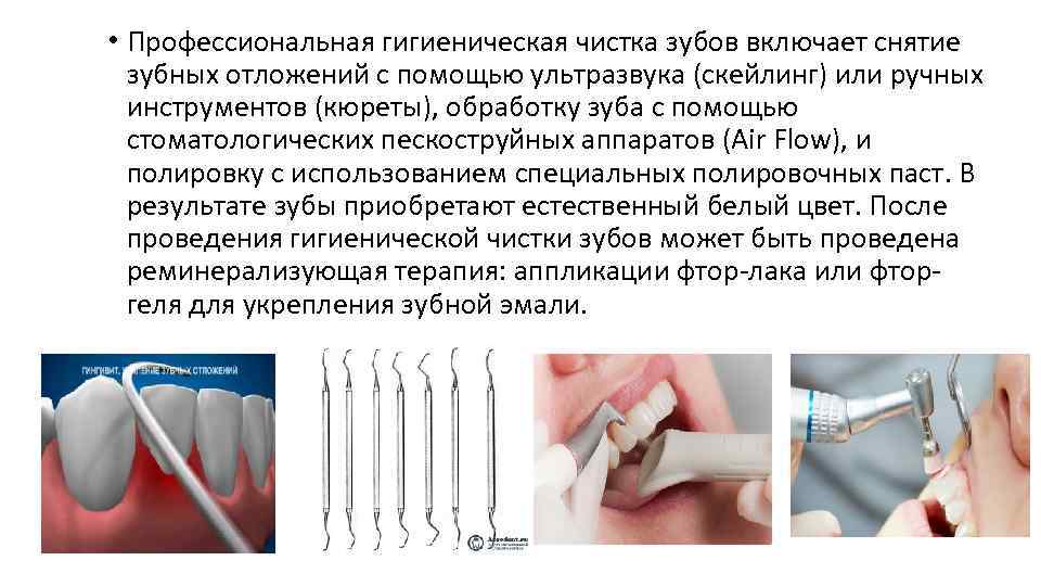  • Профессиональная гигиеническая чистка зубов включает снятие зубных отложений с помощью ультразвука (скейлинг)