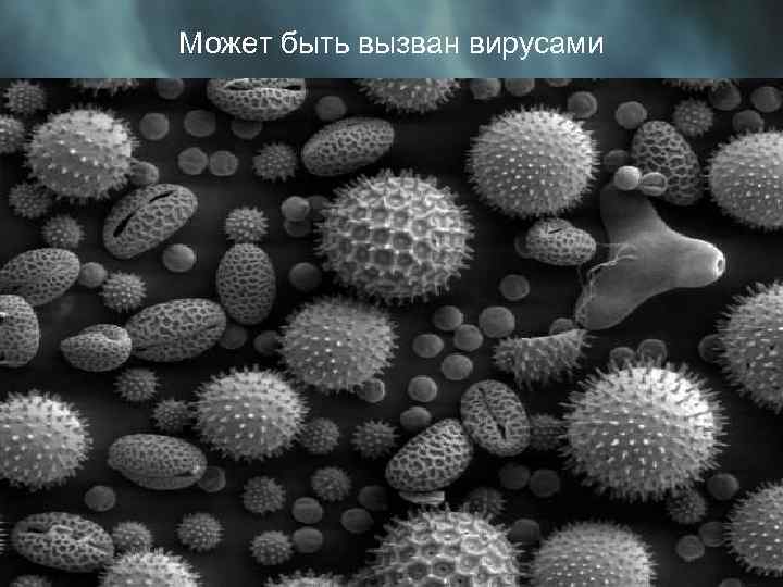 Может быть вызван вирусами 