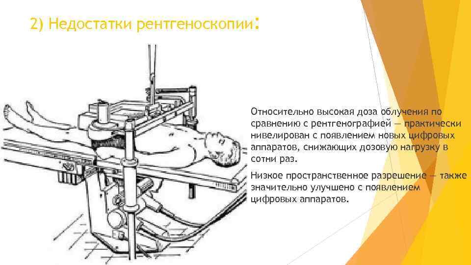 2) Недостатки рентгеноскопии: Относительно высокая доза облучения по сравнению с рентгенографией — практически нивелирован