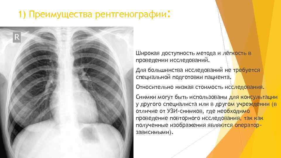 1) Преимущества рентгенографии: Широкая доступность метода и лёгкость в проведении исследований. Для большинства исследований