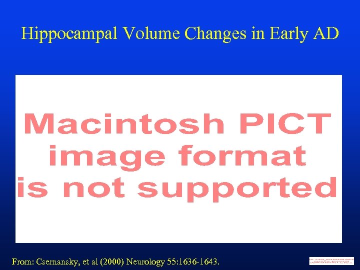 Hippocampal Volume Changes in Early AD From: Csernansky, et al (2000) Neurology 55: 1636