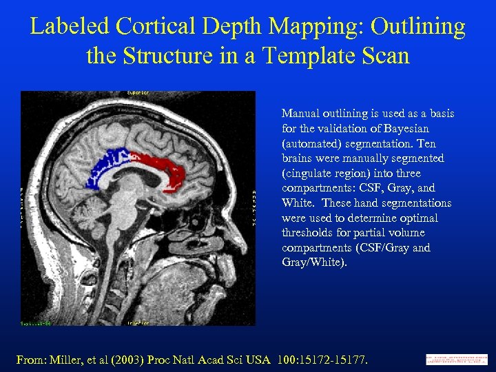 Labeled Cortical Depth Mapping: Outlining the Structure in a Template Scan Manual outlining is