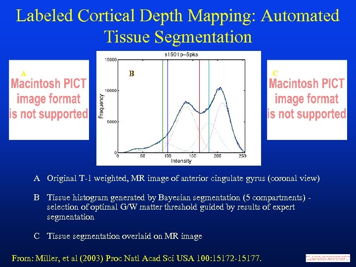 Labeled Cortical Depth Mapping: Automated Tissue Segmentation A B C A Original T-1 weighted,