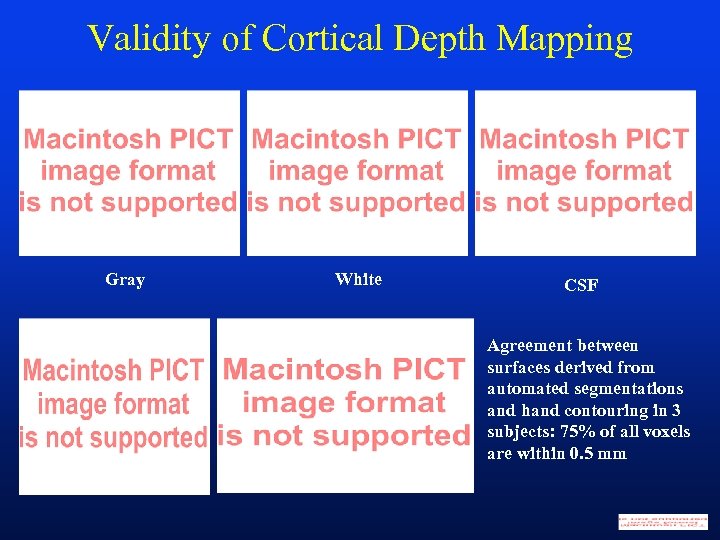 Validity of Cortical Depth Mapping Gray White CSF Agreement between surfaces derived from automated