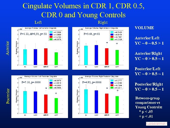 Cingulate Volumes in CDR 1, CDR 0. 5, CDR 0 and Young Controls Left