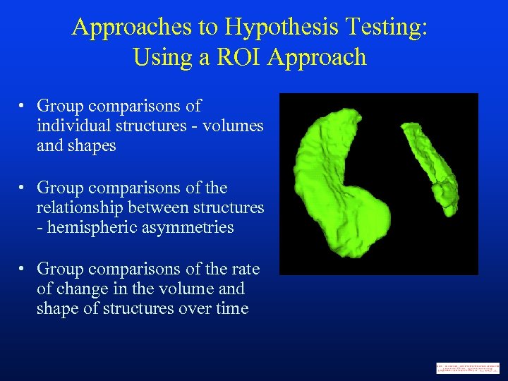 Approaches to Hypothesis Testing: Using a ROI Approach • Group comparisons of individual structures