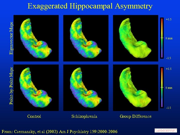 Exaggerated Hippocampal Asymmetry Eigenvector Maps +1. 5 0 mm Point-by-Point Maps -1. 5 +1.