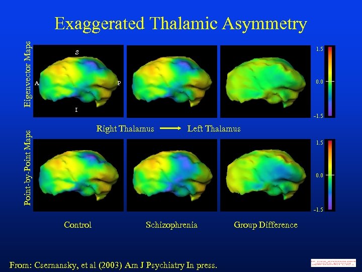 1. 5 S A 0. 0 P I -1. 5 Right Thalamus Point-by-Point Maps