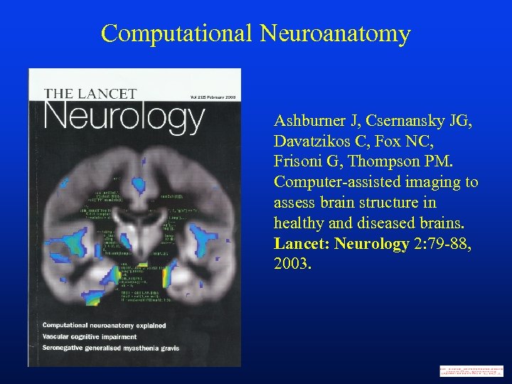 Computational Neuroanatomy Ashburner J, Csernansky JG, Davatzikos C, Fox NC, Frisoni G, Thompson PM.