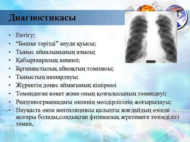 Диагностикасы • • • Ентігу; “Бөшке тәрізді” кеуде қуысы; Тыныс айналымының азаюы; Қабырғааралық кеңеюі;