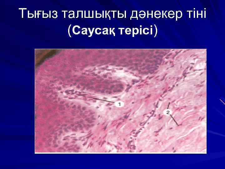 Тығыз талшықты дәнекер тіні (Саусақ терісі) 