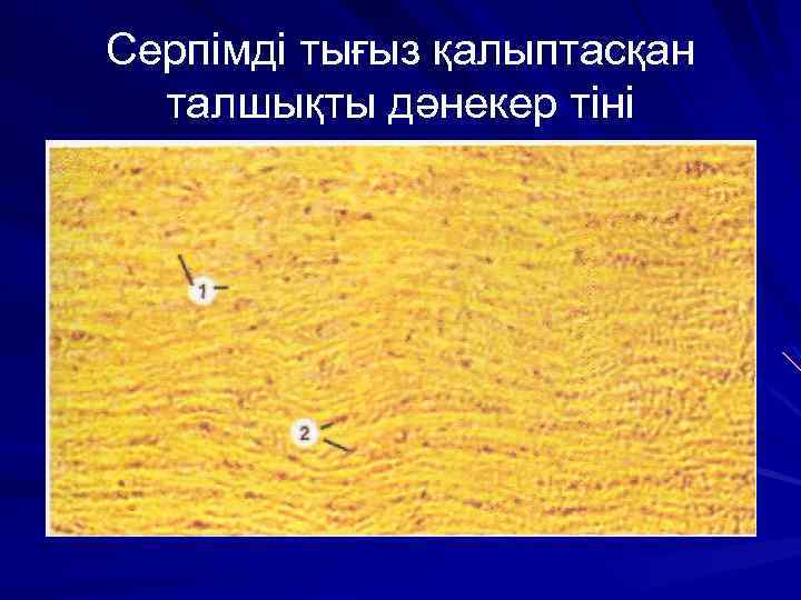 Серпімді тығыз қалыптасқан талшықты дәнекер тіні 