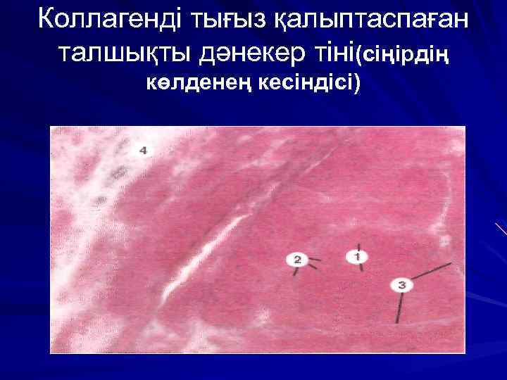 Коллагенді тығыз қалыптаспаған талшықты дәнекер тіні(сіңірдің көлденең кесіндісі) 