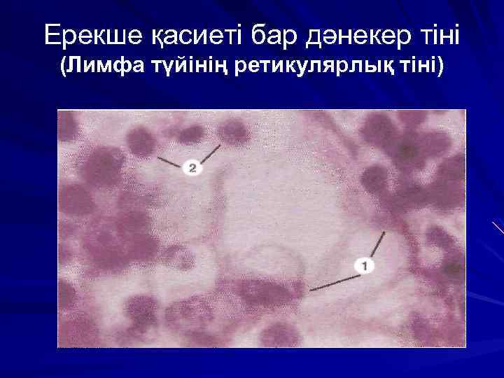 Ерекше қасиеті бар дәнекер тіні (Лимфа түйінің ретикулярлық тіні) 