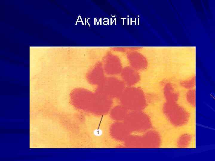 Ақ май тіні 