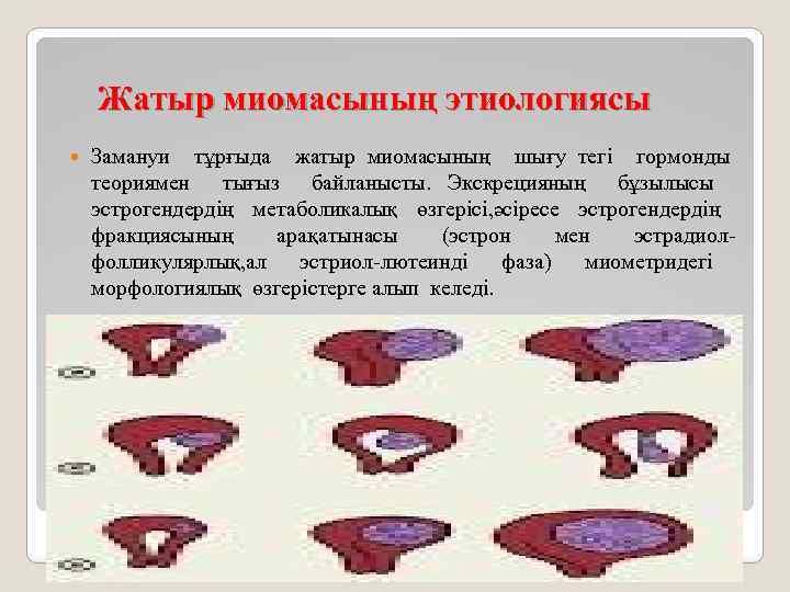 Жатыр миомасының этиологиясы Замануи тұрғыда жатыр миомасының шығу тегі гормонды теориямен тығыз байланысты. Экскрецияның