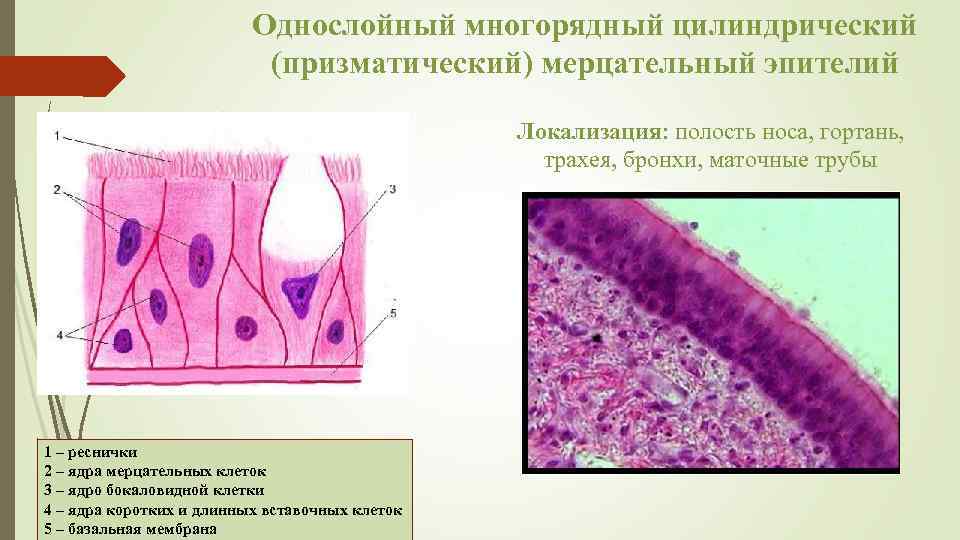 Цилиндрический эпителий в мокроте фото