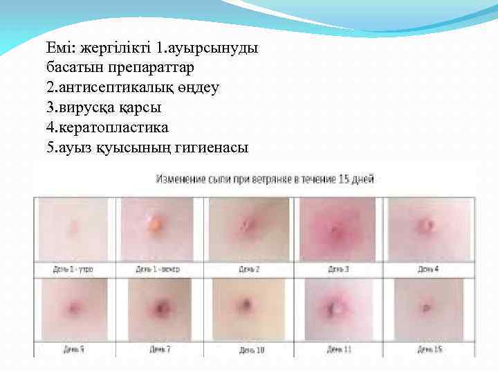 Емі: жергілікті 1. ауырсынуды басатын препараттар 2. антисептикалық өңдеу 3. вирусқа қарсы 4. кератопластика