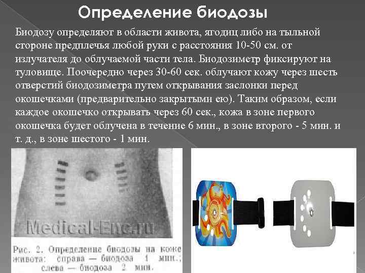 Определение биодозы Биодозу определяют в области живота, ягодиц либо на тыльной стороне предплечья любой