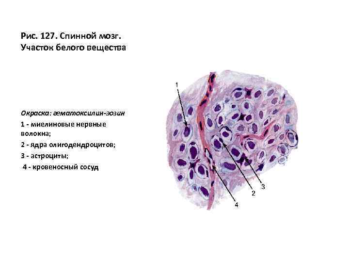 Спинномозговой узел гистология рисунок