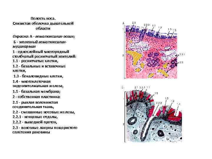 Полость носа. Слизистая оболочка дыхательной области Окраска: А - гематоксилин-эозин; Б - железный гематоксилинмуцикармин