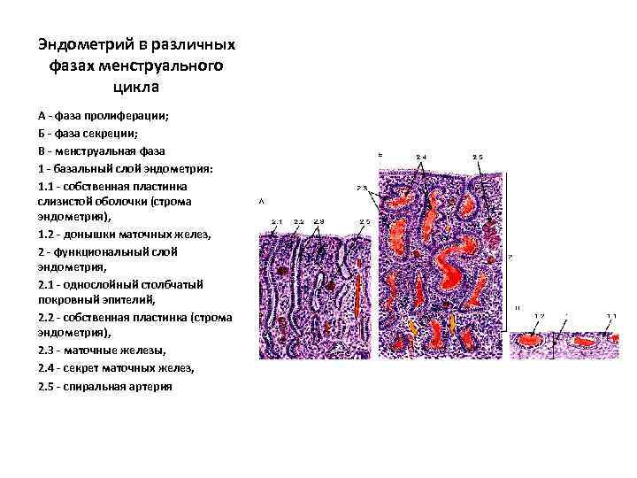 Эндометрий в различных фазах менструального цикла А - фаза пролиферации; Б - фаза секреции;