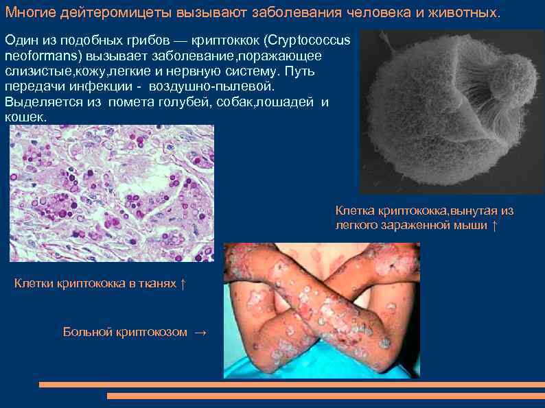 Многие дейтеромицеты вызывают заболевания человека и животных. Один из подобных грибов — криптоккок (Cryptococcus