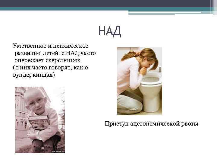 НАД Умственное и психическое развитие детей с НАД часто опережает сверстников (о них часто