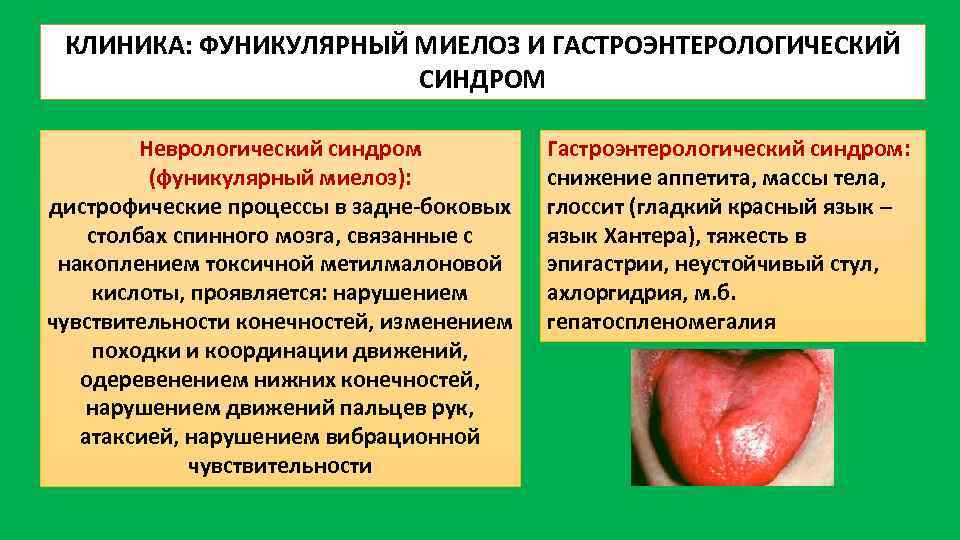 КЛИНИКА: ФУНИКУЛЯРНЫЙ МИЕЛОЗ И ГАСТРОЭНТЕРОЛОГИЧЕСКИЙ СИНДРОМ Неврологический синдром (фуникулярный миелоз): дистрофические процессы в задне-боковых