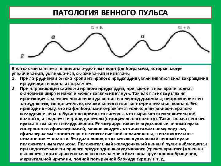 ПАТОЛОГИЯ ВЕННОГО ПУЛЬСА В патологии меняется величина отдельных волн флебограммы, которые могут увеличиваться, уменьшаться,