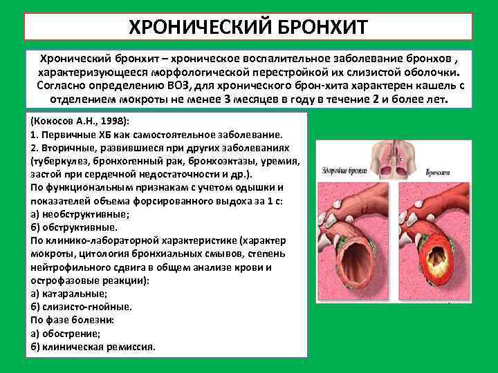 ХРОНИЧЕСКИЙ БРОНХИТ Хронический бронхит – хроническое воспалительное заболевание бронхов , характеризующееся морфологической перестройкой их