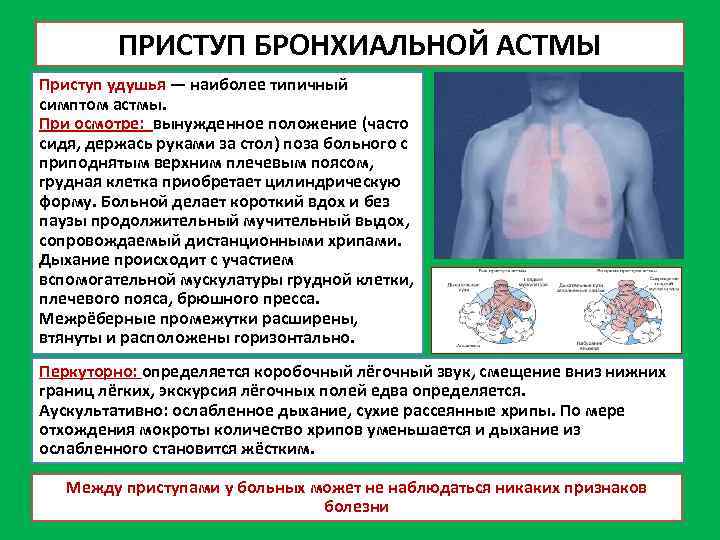 ПРИСТУП БРОНХИАЛЬНОЙ АСТМЫ Приступ удушья — наиболее типичный симптом астмы. При осмотре: вынужденное положение