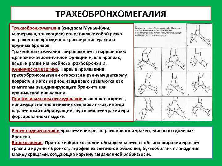 ТРАХЕОБРОНХОМЕГАЛИЯ Трахеобронхомегалия (синдром Мунье Куна, мегатрахея, трахеоцеле) представляет собой резко выраженное врожденное расширение трахеи