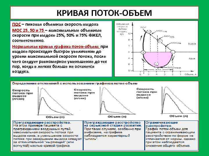 КРИВАЯ ПОТОК ОБЪЕМ ПОС – пиковая объемная скорость выдоха МОС 25, 50 и 75