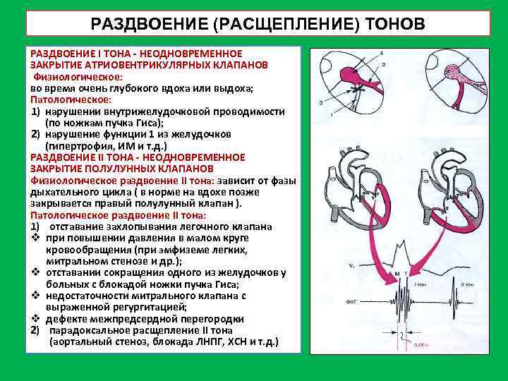 Стеноз митрального клапана аускультация