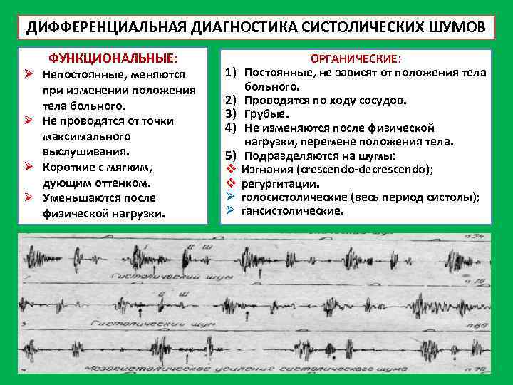 ДИФФЕРЕНЦИАЛЬНАЯ ДИАГНОСТИКА СИСТОЛИЧЕСКИХ ШУМОВ ФУНКЦИОНАЛЬНЫЕ: Ø Непостоянные, меняются при изменении положения тела больного. Ø