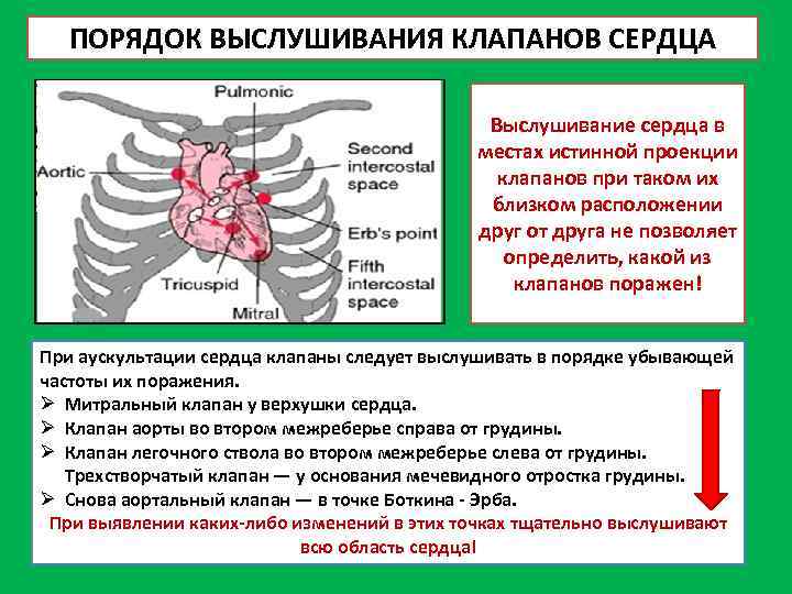 ПОРЯДОК ВЫСЛУШИВАНИЯ КЛАПАНОВ СЕРДЦА Выслушивание сердца в местах истинной проекции клапанов при таком их