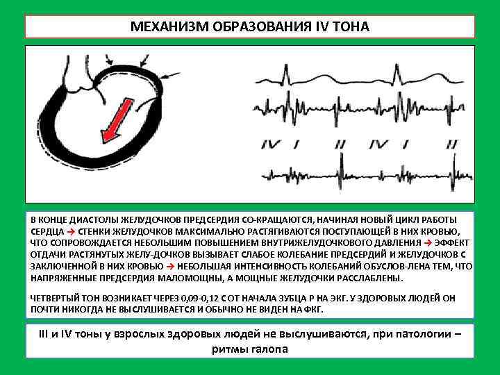 МЕХАНИЗМ ОБРАЗОВАНИЯ IV ТОНА В КОНЦЕ ДИАСТОЛЫ ЖЕЛУДОЧКОВ ПРЕДСЕРДИЯ СО КРАЩАЮТСЯ, НАЧИНАЯ НОВЫЙ ЦИКЛ