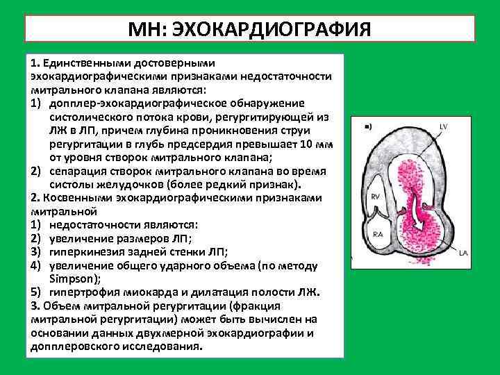 МН: ЭХОКАРДИОГРАФИЯ 1. Единственными достоверными эхокардиографическими признаками недостаточности митрального клапана являются: 1) допплер-эхокардиографическое обнаружение