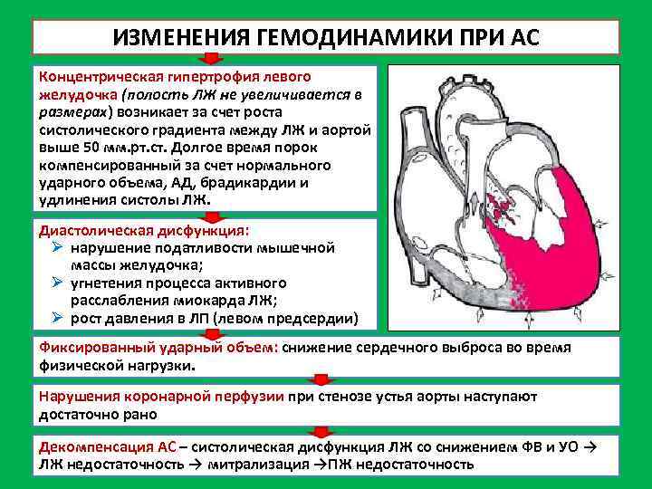 Левый желудочек изменения