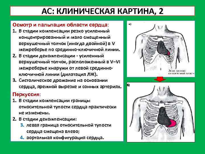 Пальпация сердца