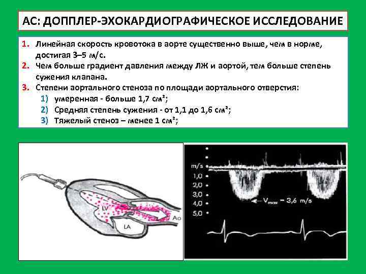 Измерение скорости кровотока. Скорость аортального кровотока. Скорость кровотока в аорте норма. Трансаортальный кровоток норма. Скорость кровотока допплер.