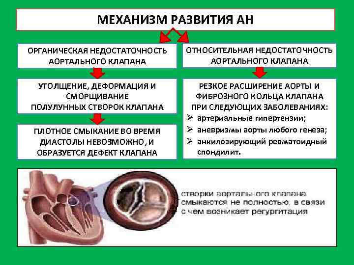 МЕХАНИЗМ РАЗВИТИЯ АН ОРГАНИЧЕСКАЯ НЕДОСТАТОЧНОСТЬ АОРТАЛЬНОГО КЛАПАНА ОТНОСИТЕЛЬНАЯ НЕДОСТАТОЧНОСТЬ АОРТАЛЬНОГО КЛАПАНА УТОЛЩЕНИЕ, ДЕФОРМАЦИЯ И