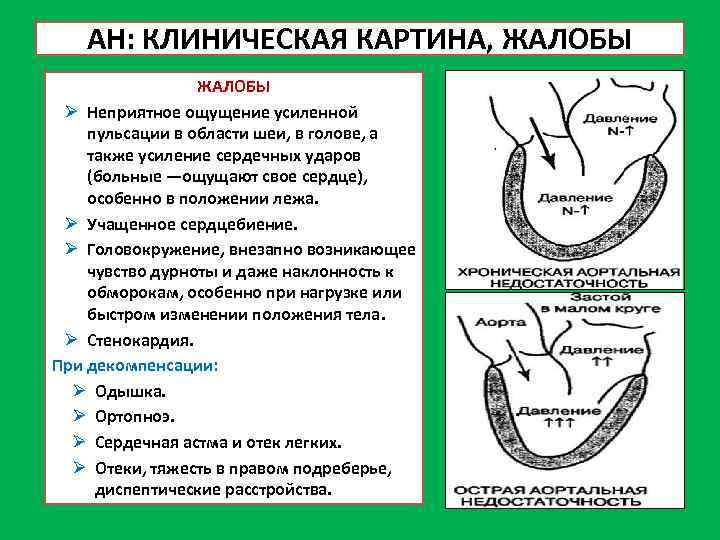 АН: КЛИНИЧЕСКАЯ КАРТИНА, ЖАЛОБЫ Ø Неприятное ощущение усиленной пульсации в области шеи, в голове,