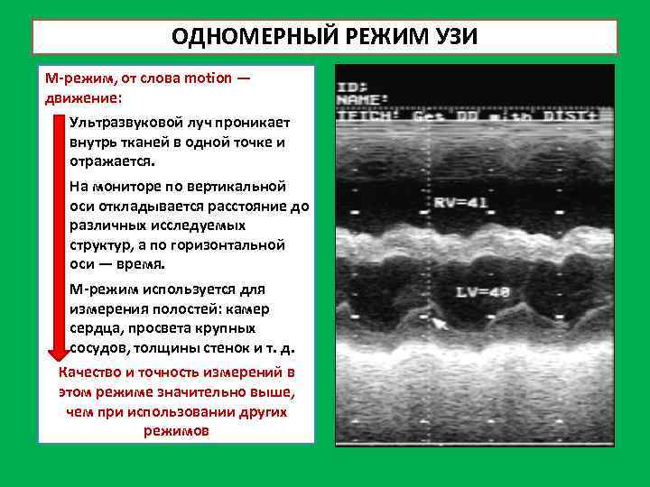 Режимы ультразвукового исследования