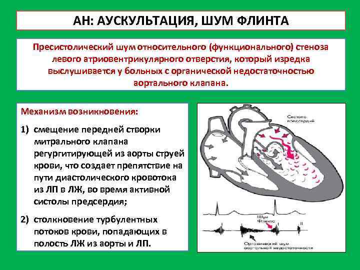 АН: АУСКУЛЬТАЦИЯ, ШУМ ФЛИНТА Пресистолический шум относительного (функционального) стеноза левого атриовентрикулярного отверстия, который изредка