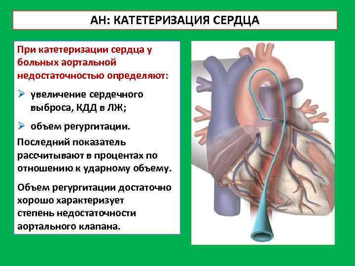 АН: КАТЕТЕРИЗАЦИЯ СЕРДЦА При катетеризации сердца у больных аортальной недостаточностью определяют: Ø увеличение сердечного